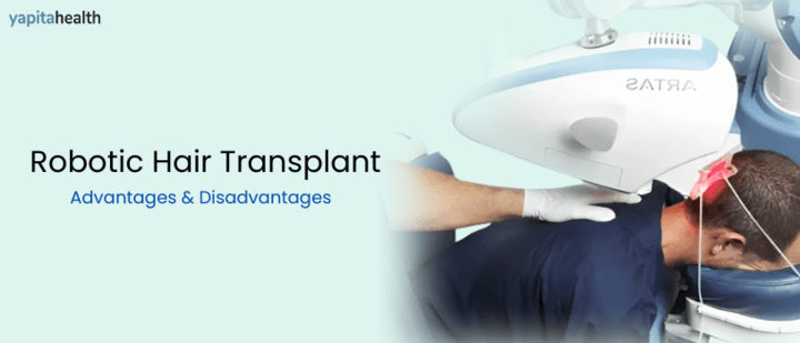What is Robotic Hair Transplant - Advantages & Disadvantages