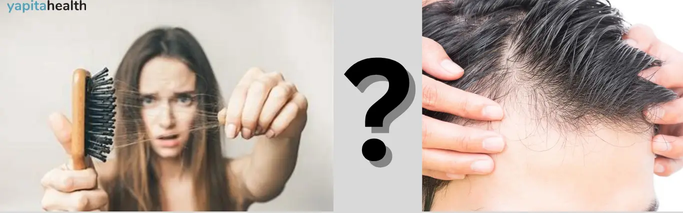 Myths and Facts About Hair Loss They Don’t Tell You!