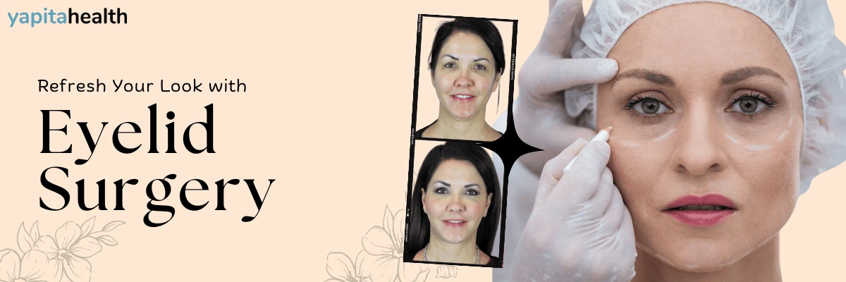 Eyelid Surgery in Turkey - Yapita Health