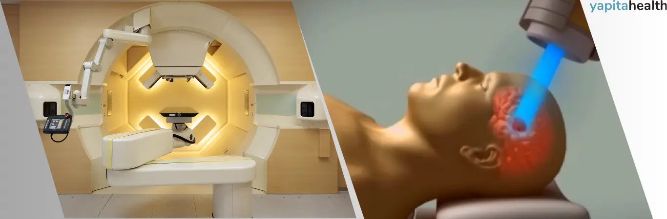 Types of cancer that can be treated with proton therapy