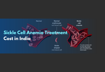 Sickle Cell Anemia treatment Cost in India