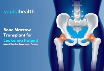 Bone Marrow Transplant for Leukemia - Yapita Health