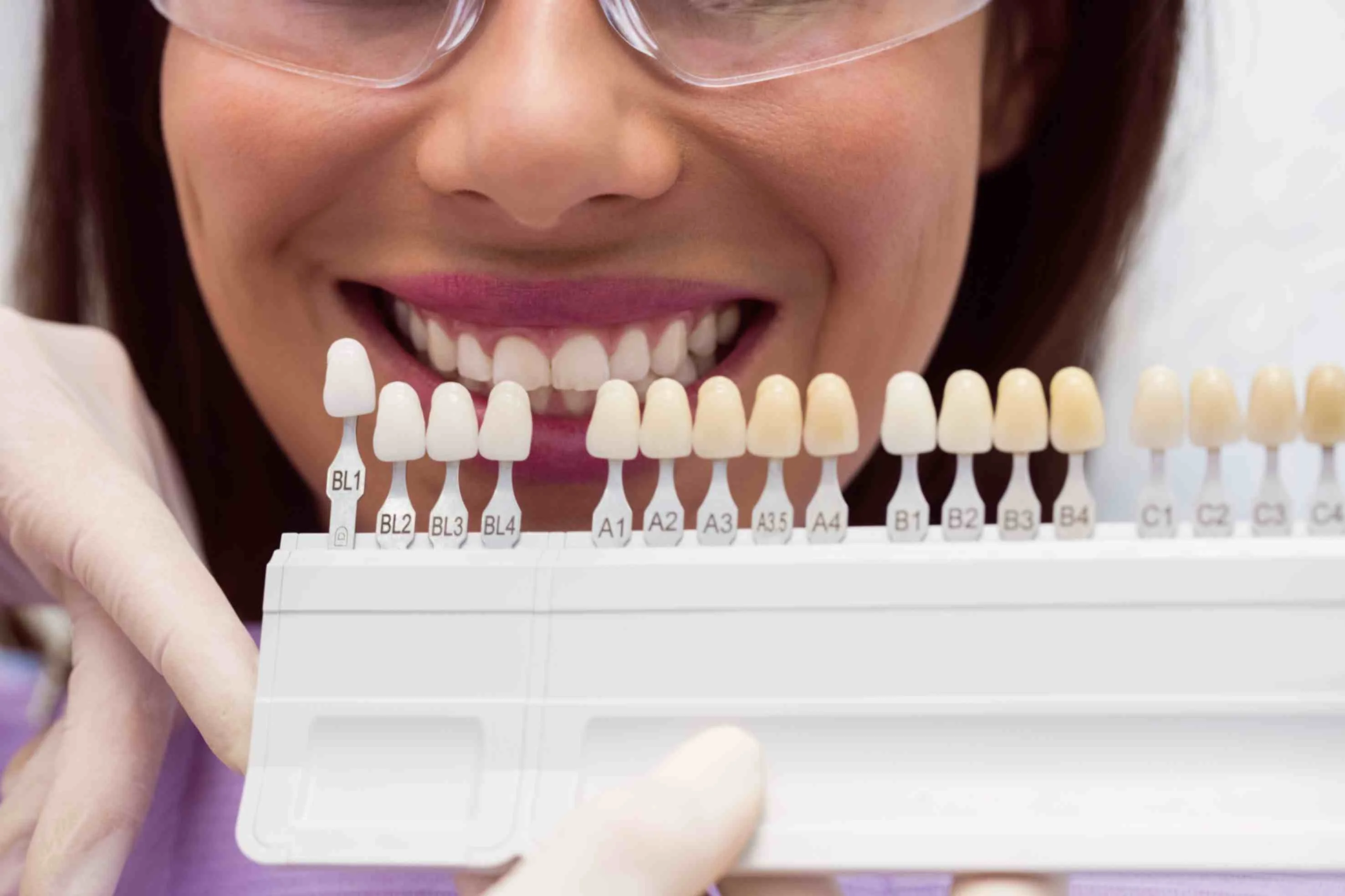 20 E-Max Veneers Turkey